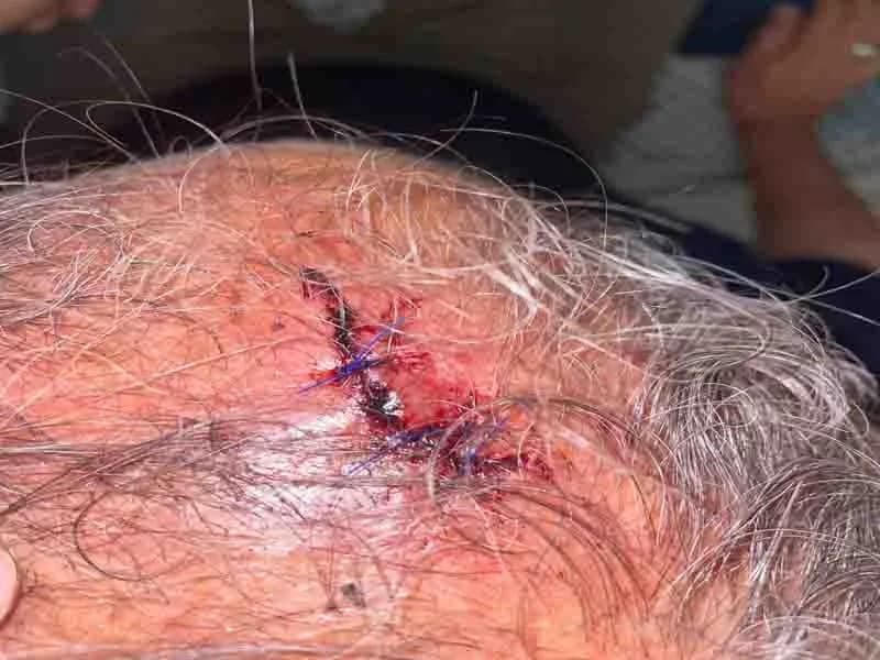 Saldırıya uğradı, ölümden döndü, saldırgan serbest bırakıldı
